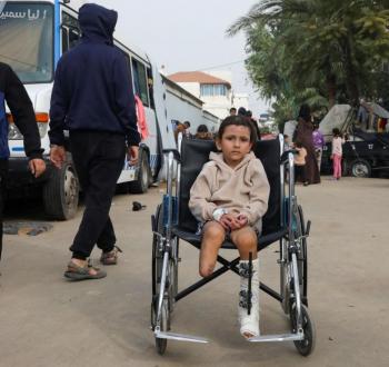 بتر أطراف الأطفال