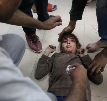 طفلة فلسطينية مصابة برصاص الاحتلال.jpg