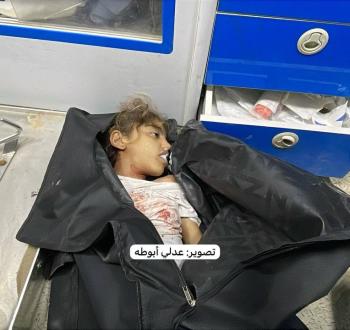 طفلة شهيدة