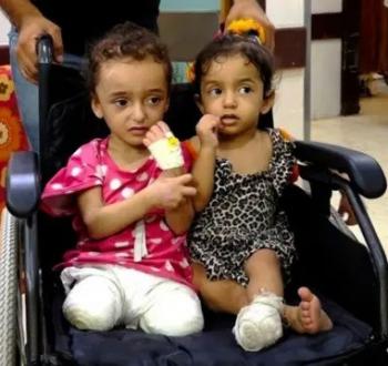 أطفال غزة أطرافًا صناعية مجانية