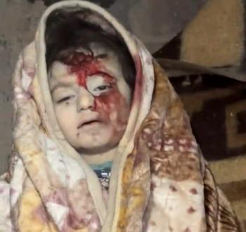 طفلة شهيدة في قصف حي الشيخ رضوان
