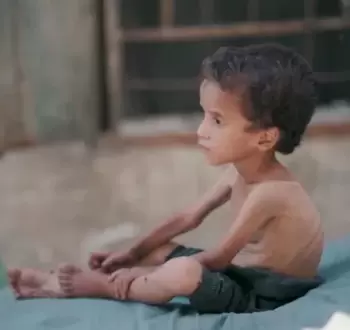 تجويع غزة