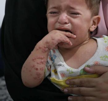 غزة