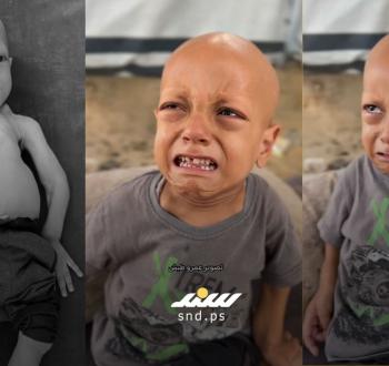 الطفل عبد الله .. أنا جعان.jpeg