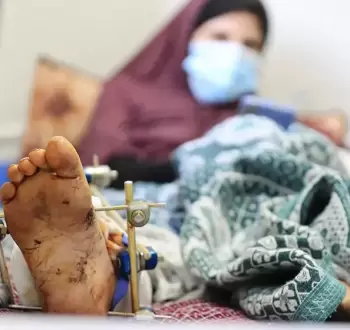 جرحى غزة.