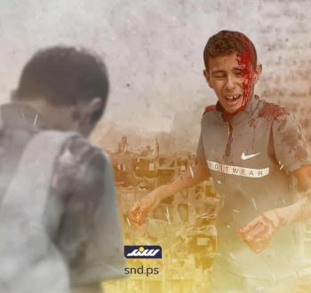 الطفل أحمد أبو سكران