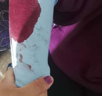 اعتداء على متضامنة أجنبية