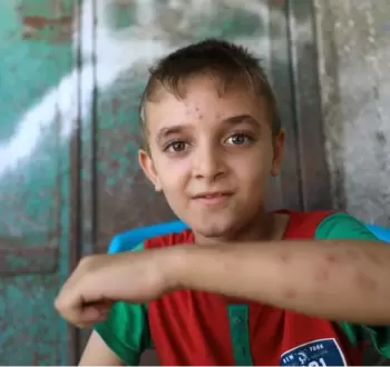 إصابة العديد من أطفال غزة بأمراض جلدية نتيجة تلوث المياه