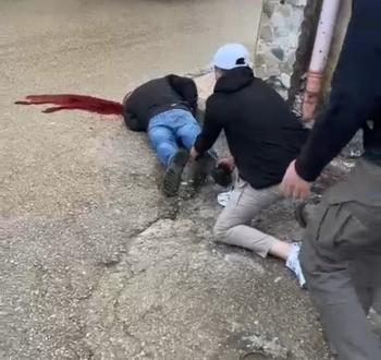 إصابة حرجة في قلنديا