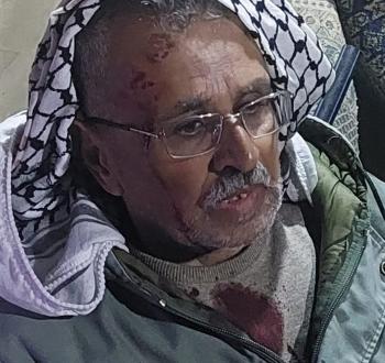 مستوطنون اعتداء