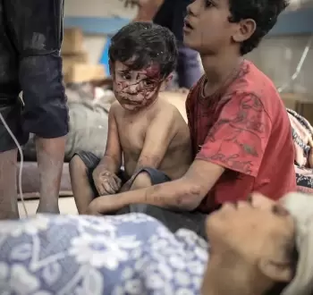أطفال من غزة مصابون بقصف إسرائيلي
