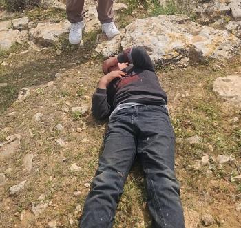 إصابة طفل في المسافر