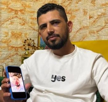 إصابة شاب مقدسي باعتداءات المستوطنين