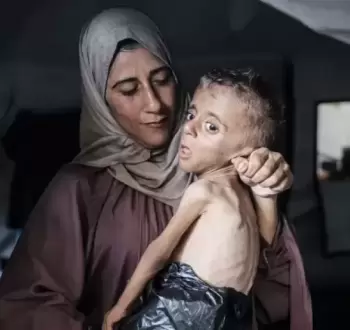سيدة ترعى طفلها المريض في غزة.webp