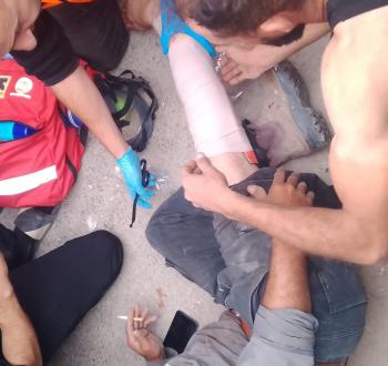 إصابة مواطن باعتداء جنود الاحتلال