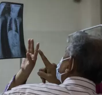 الحصبة