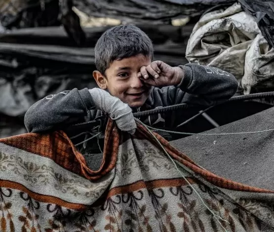 طفل فلسطيني مصاب بقصف الاحتلال في قطاع غزة.webp