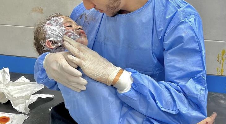 إصابة طفل بالقصف الإسرائيلي على غزة