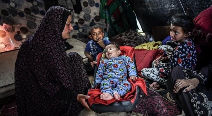 أطفال يُعانون من الجوع في غزة.jpg