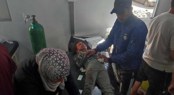 طفلة فلسطينية أصيبت في استهداف مدرسة تؤوي نازحين في النصيرات وسط غزة.jpg
