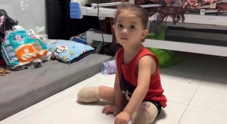 طفلة بترت ساقاها بقصف إسرائيلي على غزة