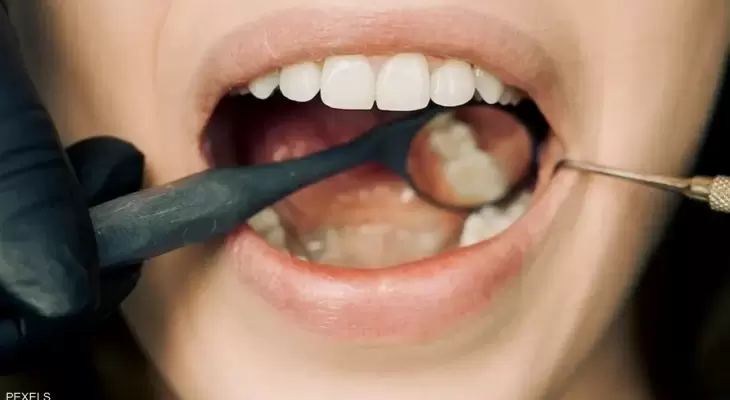 أمراض الفم