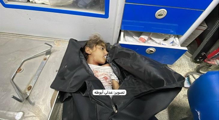 طفلة شهيدة