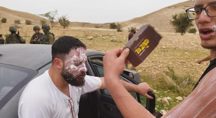 إصابات باعتداء للمستوطنين.jpg