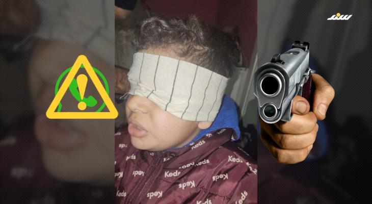 الطفل أحمد الديك