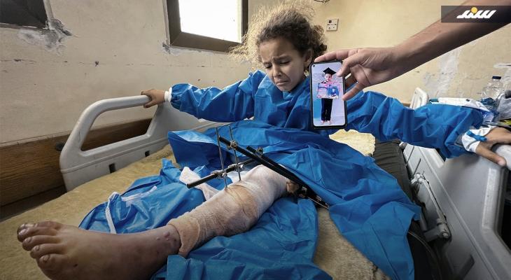 معاناة متصاعدة تعانيها الطفلة سيلا ماضي