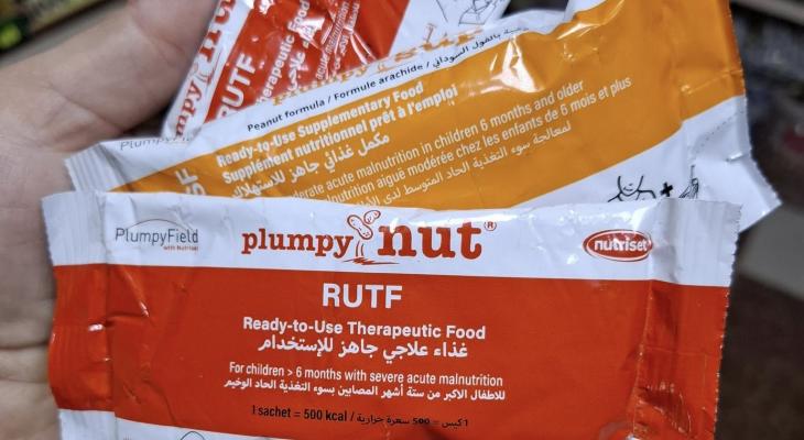 شروط ومواعيد استقبال حالات سوء التغذية في مستشفى أصدقاء المريض