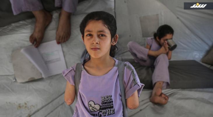 الطفلة سارة بلا ذراعين