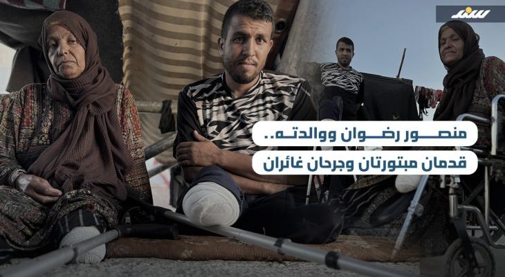 منصور رضوان ووالدته.. قدمان مبتورتان