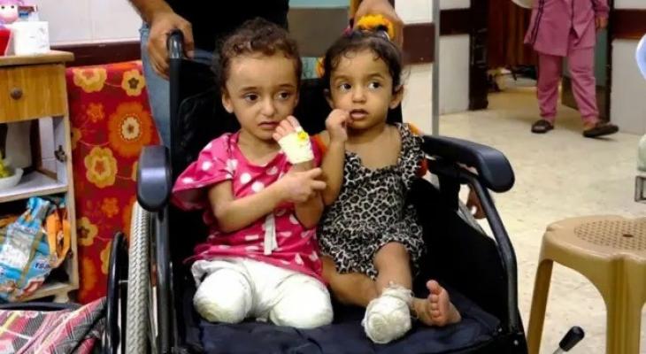 أطفال غزة أطرافًا صناعية مجانية