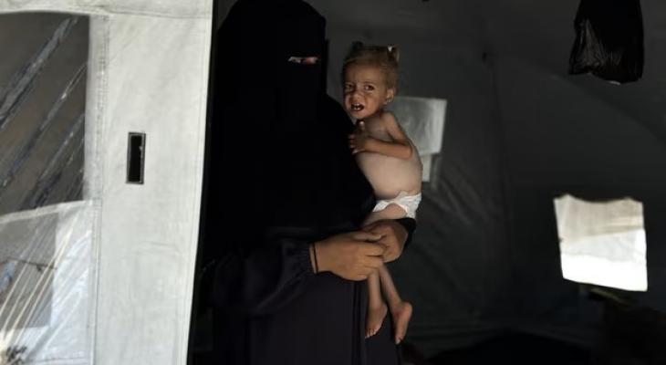 الحليب في غزة55.jpg