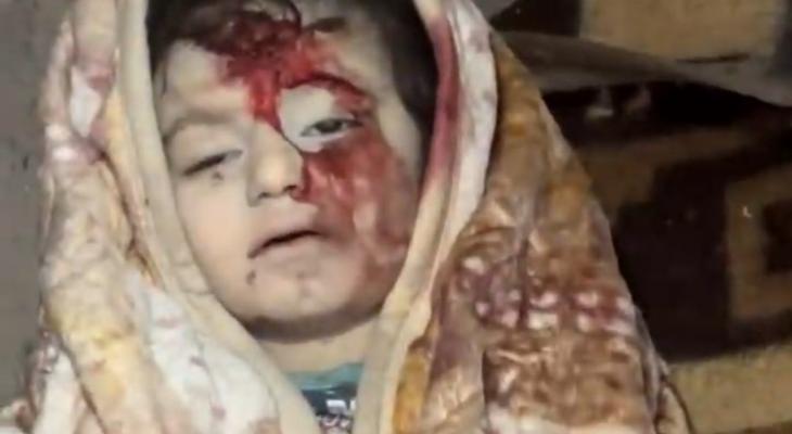 طفلة شهيدة في قصف حي الشيخ رضوان