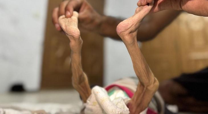 تجويع غزة.jpg