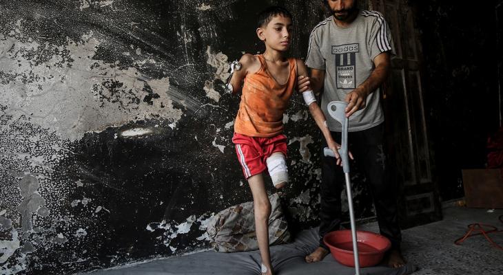 سمير بين الركام.. جسد مبتور وأملٌ بالنجاة3.jpg