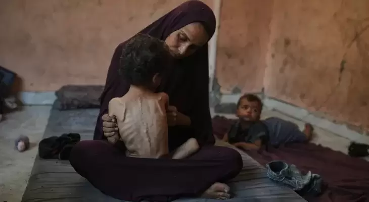 تجويع غزة