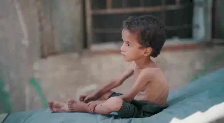 تجويع غزة
