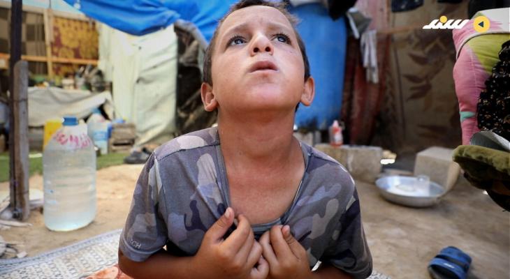 حساسية الحرارة... أطفال غزة يتألمون وسط غياب الأدوية