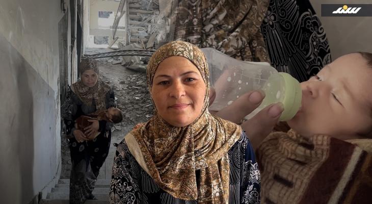 سوء التغذية