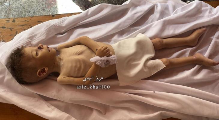 الطفل سيف حلس شهيد جراء المجاعة.jpg