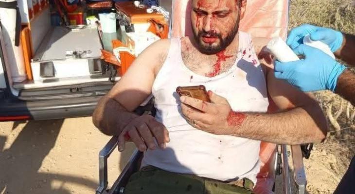 إصابات باعتداءات للمستوطنين على قاطفي الزيتون