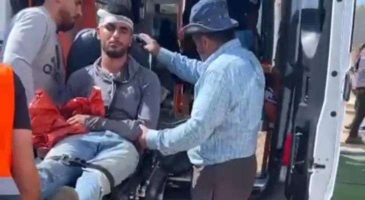 إصابة اعتداء للمستوطنين
