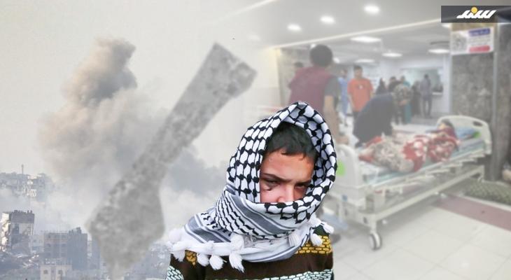 مرضى العيون