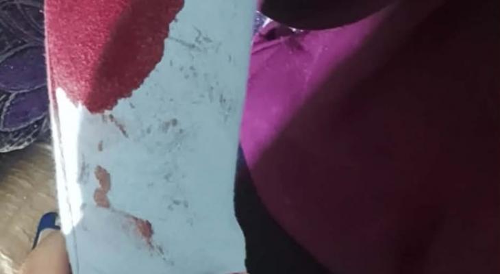 اعتداء على متضامنة أجنبية