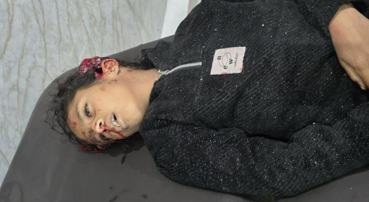 شهيدتان بقصف إسرائيلي لخيام النازحين وسط قطاع غزة
