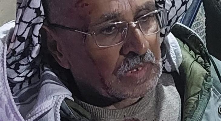 مستوطنون اعتداء