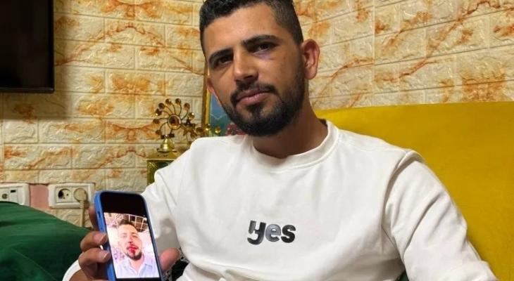 إصابة شاب مقدسي باعتداءات المستوطنين